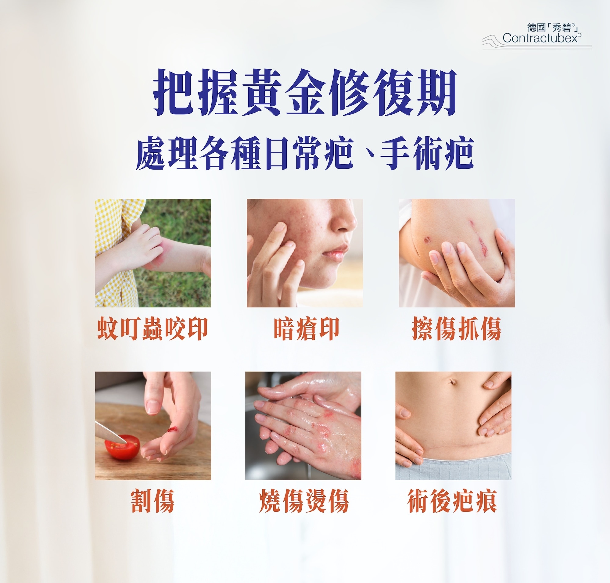 德國「秀碧®」除疤膏20克