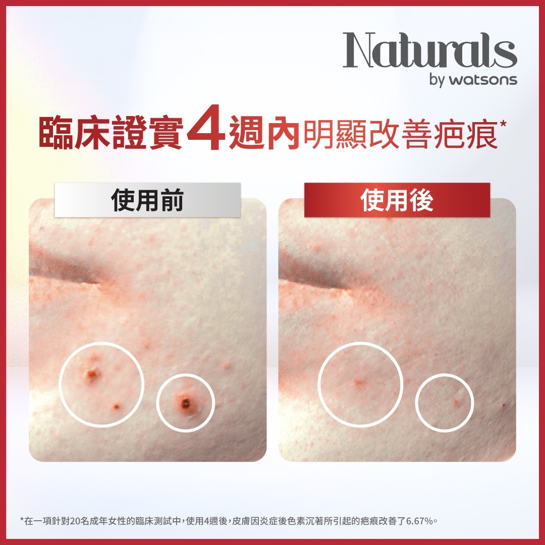 玫瑰果极致修护活肤油