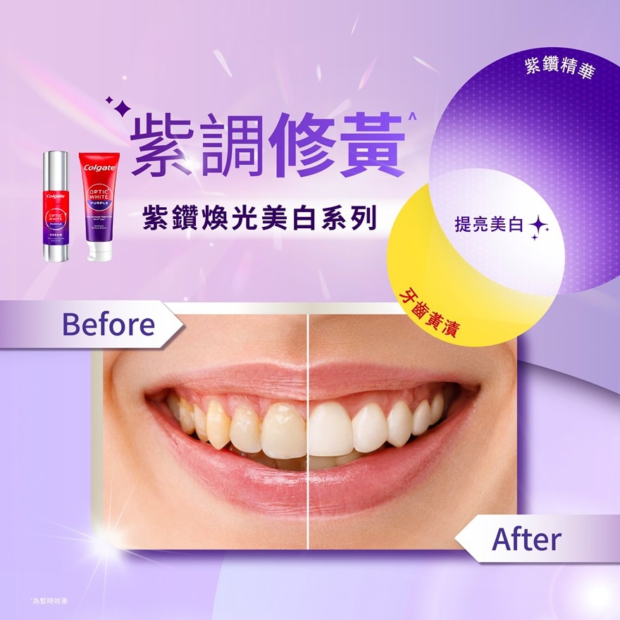 高露潔xIU紫色牙膏.精華.牙刷限量禮盒 (送IU筆記本+小卡)