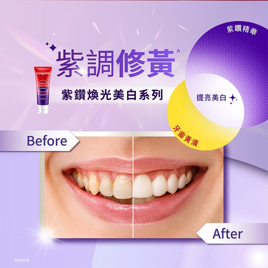 高露洁xIU紫色牙膏3支装.牙刷限量礼盒(送IU帆布袋+贴纸+小卡)