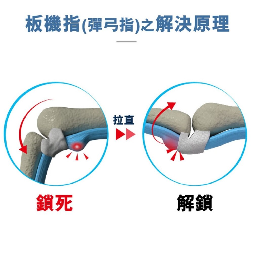 MEDEX Trigger Finger Splint Medical Equipment Watsons Hong Kong