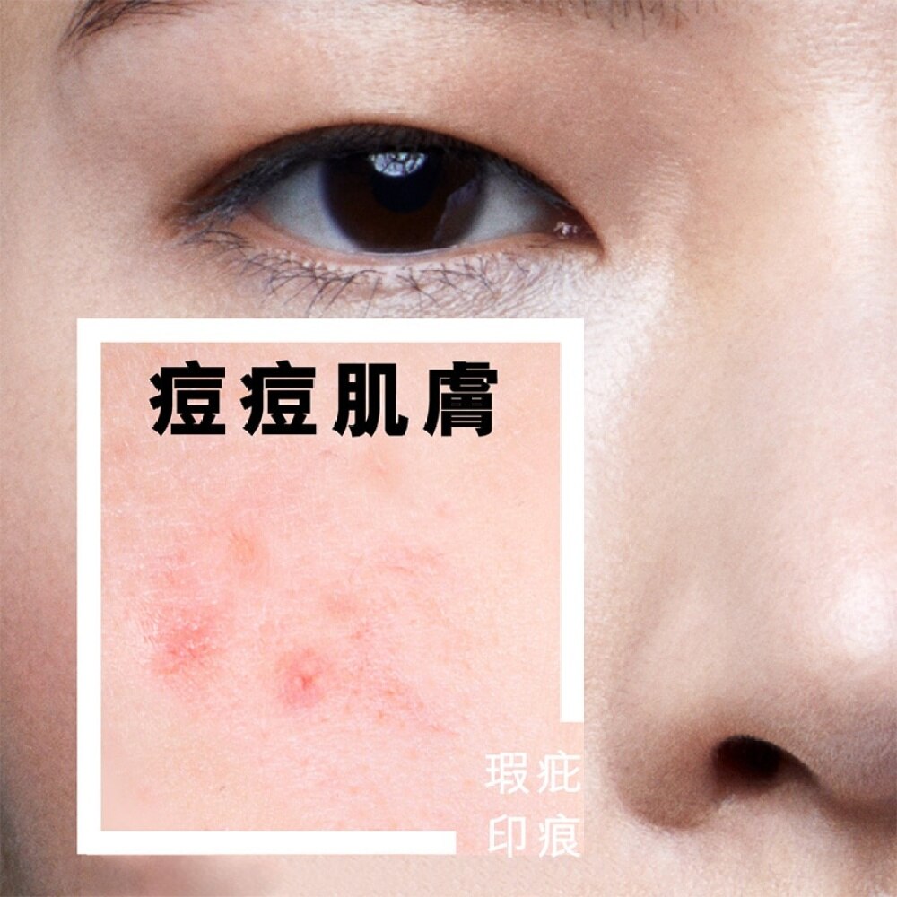 LA ROCHE POSAY Effaclar A.I. 15ML | Derma Cosmetics | Watsons Hong Kong