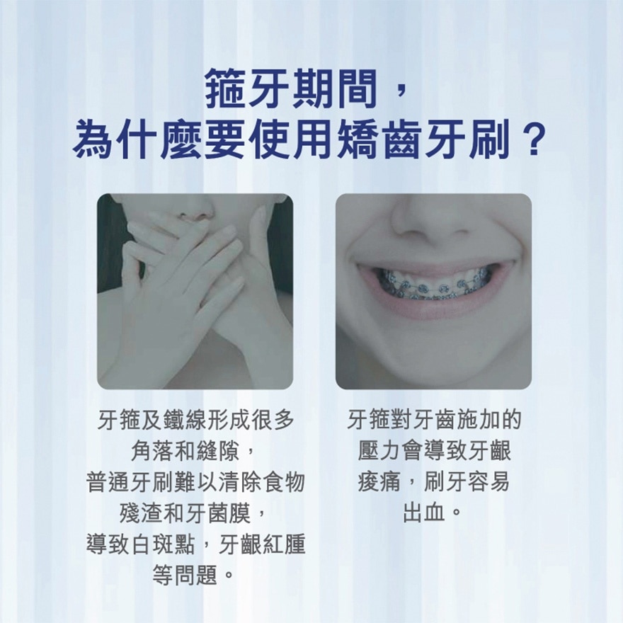 高露洁 - 纤柔矫正软毛牙刷 (U型刷毛 矫齿箍牙专用) (颜色随机)