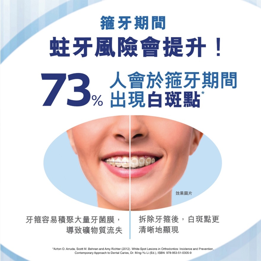 高露潔 - 纖柔矯正軟毛牙刷 (U型刷毛 矯齒箍牙專用) (顏色隨機)