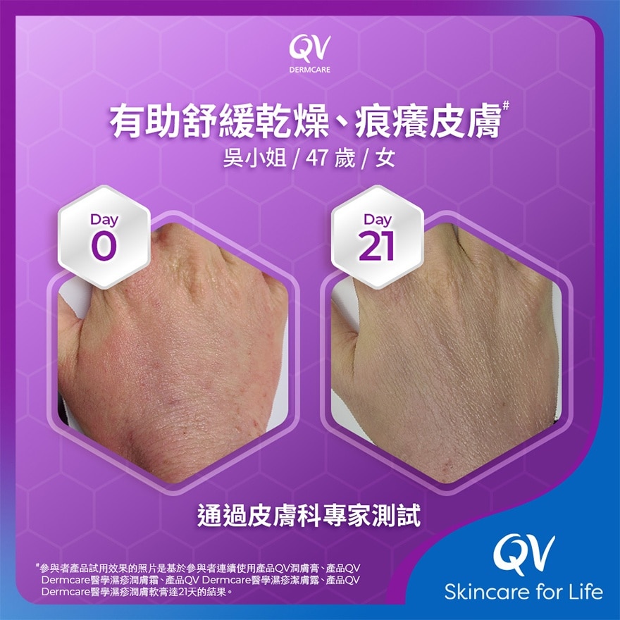 QV Dermcare Daily Wash (Ceramides) 350ML 