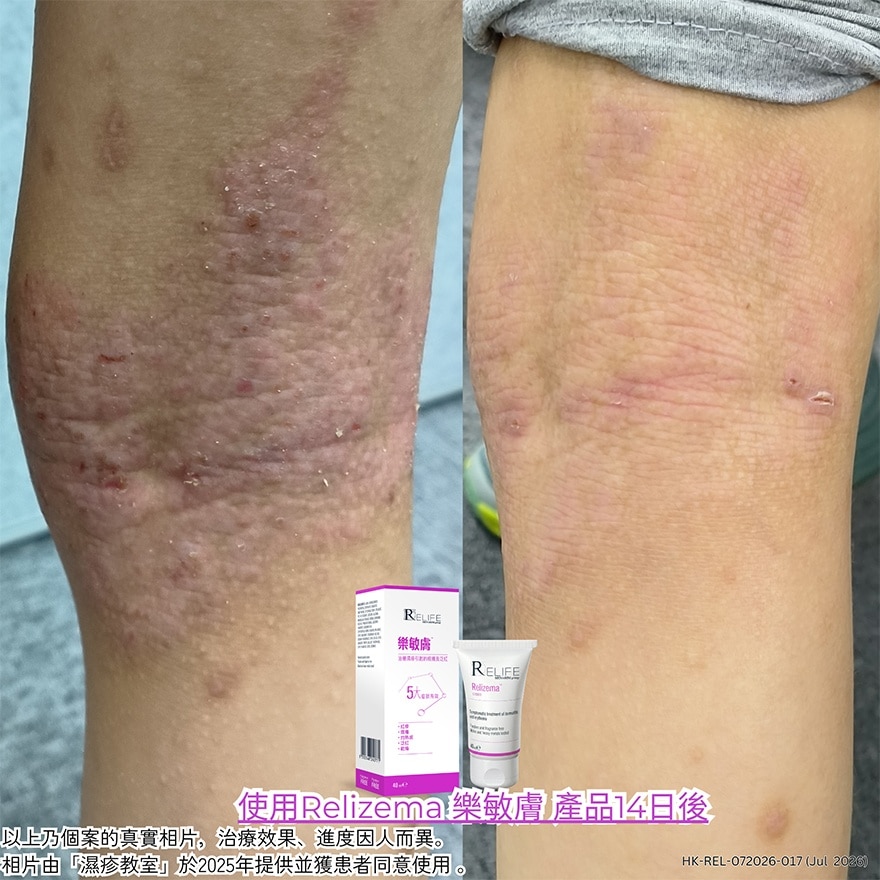 乐敏肤抗氧治療潤膚膏40亳升 image