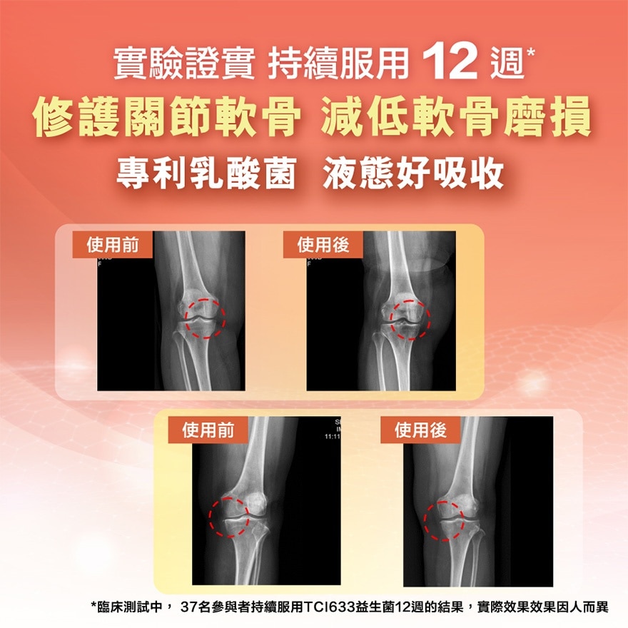 強。關節雙營液體葡萄糖胺 15包