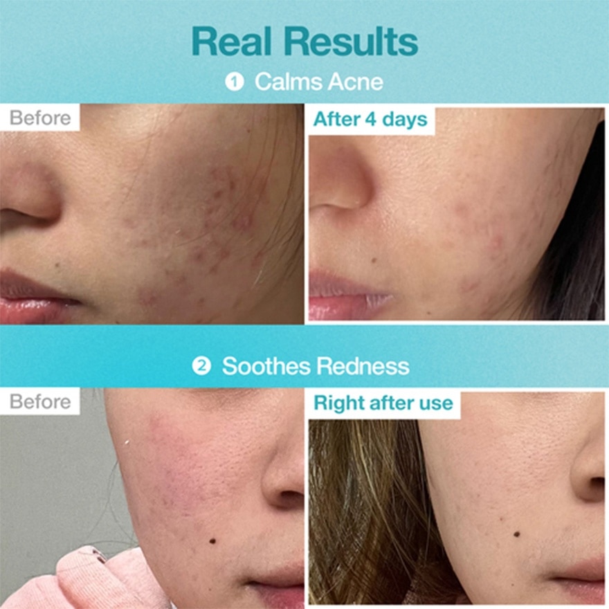 NO.1 PANTOTHENIC B5 HYALURONIC MASK