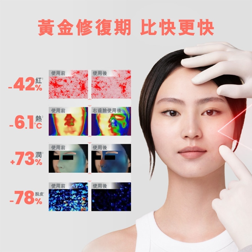 密集修護面膜 5片 image